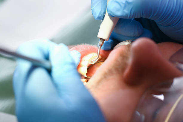 Best Weekend Emergency Dentist in Reno, OH