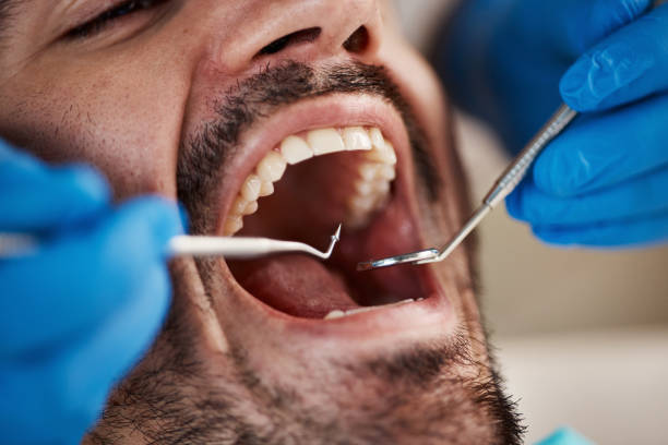 Best Emergency TMJ Treatment in Reno, OH