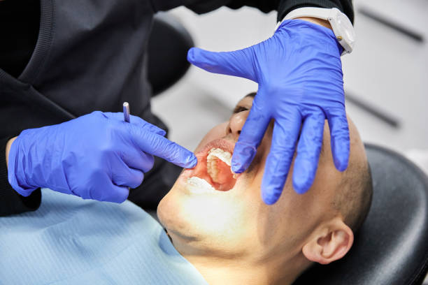 Best Emergency Dental Care for Broken or Chipped Teeth in Reno, OH