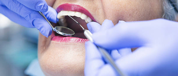 Best Emergency Tooth Extraction in Reno, OH
